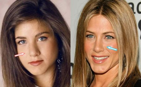 Jennifer Aniston & Plastic Surgery: The Truth About the Rumors