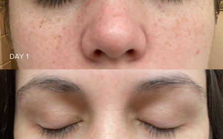 Vitamin C Serum Before & After: Real Results & Skincare Benefits