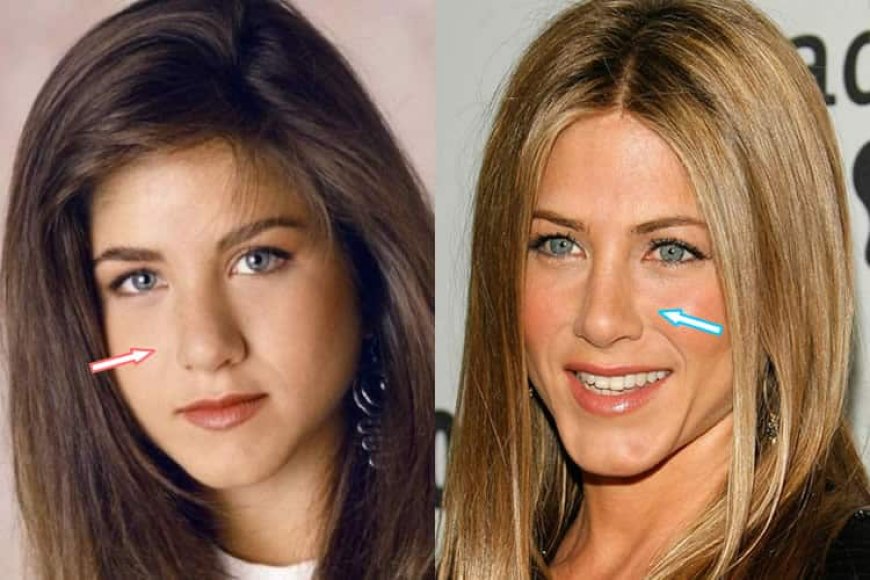 Jennifer Aniston & Plastic Surgery: The Truth About the Rumors